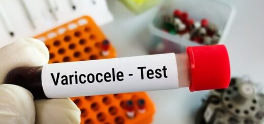 Varicocèle Varices des testicules