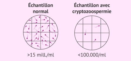Soigner Cryptozoospermie Naturellement