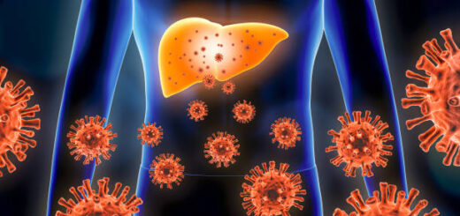 Causes Symptômes Hépatite C