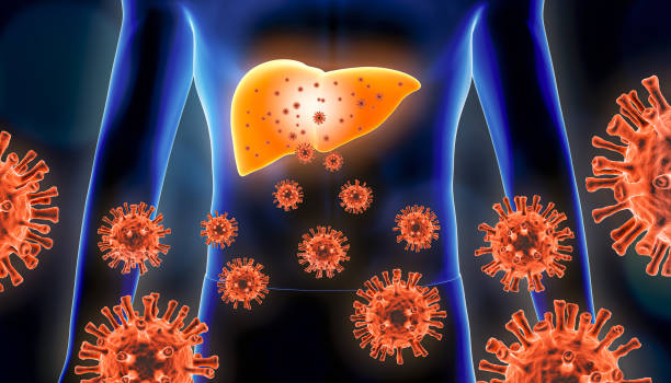Causes Symptômes Hépatite C