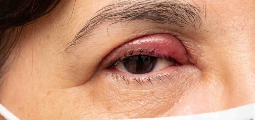 Infections à staphylocoques