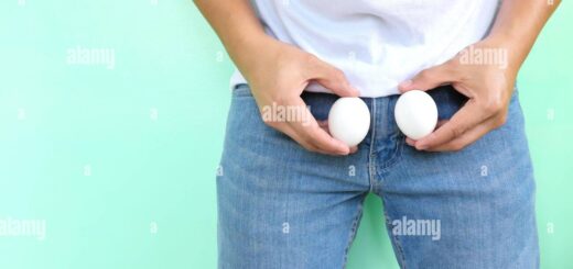 Varicocèle Gauche Varicocèle Bilatérale