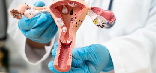 Fibrome Remède Naturel