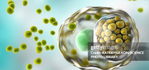 Infections à Chlamydia