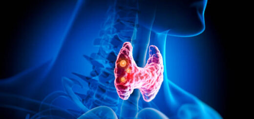 Remède Naturel Fièvre typhoïde, traitement Fièvre typhoïde