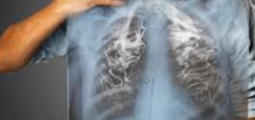 Le tabac et ses associés : Danger du Tabagisme