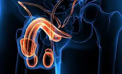 Varicocèle Bilatérale, Causes, Traitements
