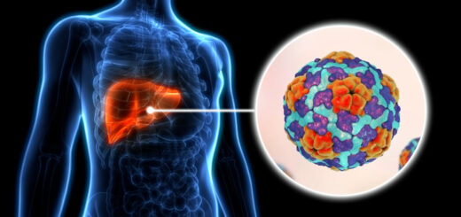 Solutions Complémentaires Pour Soigner Hépatite B