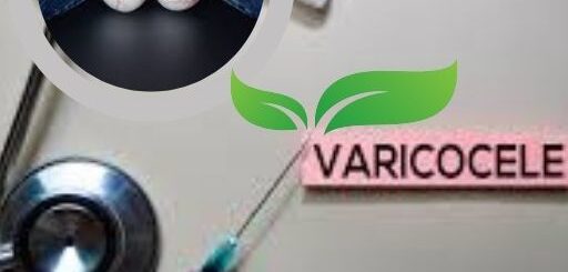 Comment traiter la varicocèle?