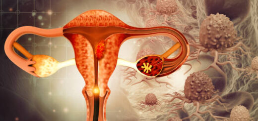 Le Cancer du Col de l'Utérus Soins Naturels