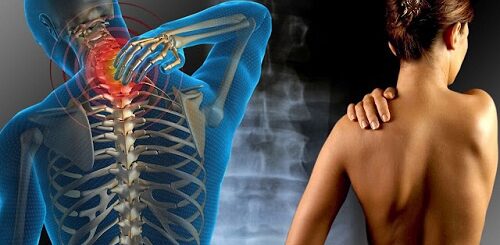 Fibromyalgie Quel Traitement Efficace?