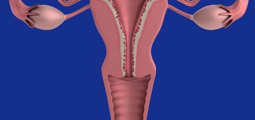 Dysplasie Olfacto-génitale Remède Syndrome de Kallmann