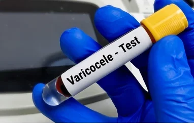 Définition Causes Symptômes Traitements Varicocèle