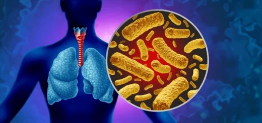 Coqueluche Généralités et Traitement Naturel