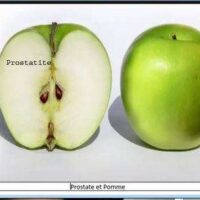 Maladies de la Prostate Traitement Plantes
