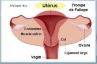 Cancer de l'Utérus Remède Naturel
