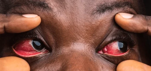 Maladies des Yeux : 20 Aliments Bons Pour Les Yeux