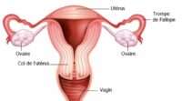 Remède Naturel Inflammation Col de l'Utérus