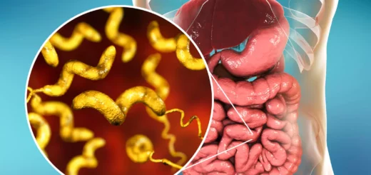 Campylobacteriose Causes et Remède Naturel