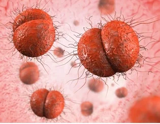 Gonorrhée Comment Traiter l'Infection ?