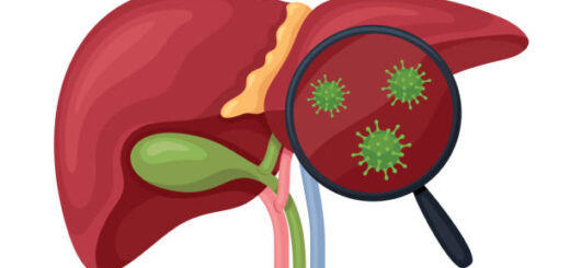 Traitement Naturel Hépatite C au Cameroun
