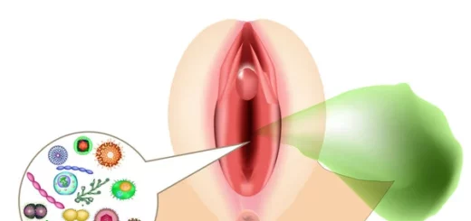 Vulvite Causes et Solution Naturelle
