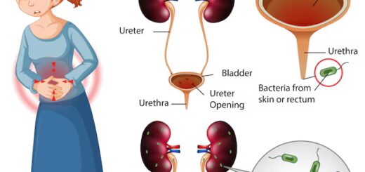 Infection De l'Urètre : Symptômes et Traitement Naturel de l'Urétrite