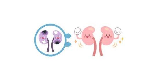 L'agénésie rénale symptômes et traitement