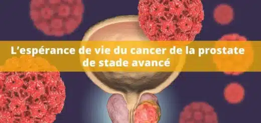 Soigner le Cancer de la Prostate : Remède Naturel