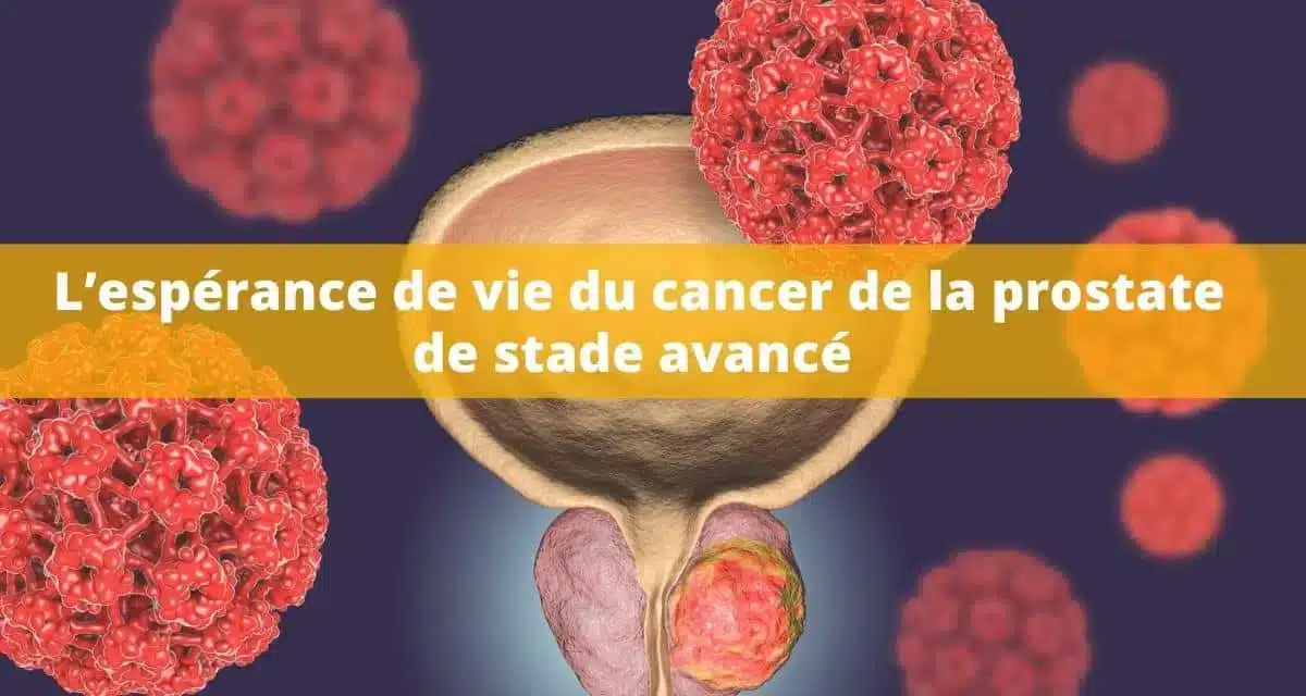 Soigner le Cancer de la Prostate : Remède Naturel