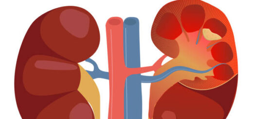 La Pyélonéphrite :Causes , Soin Et Traitement Naturel