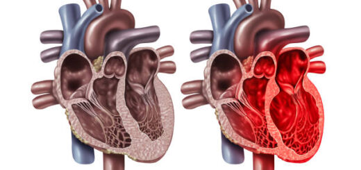 Le syndrome pulmonaire à l'hantavirus traitement naturel