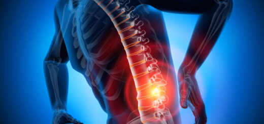 L'hernie Discale : Définition Conséquence et Traitement Naturel