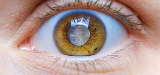 Traitement Naturel Contre Tension Oculaire Glaucome