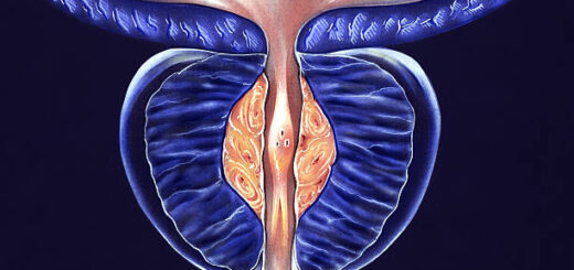 Plantes naturelles pour soigner la prostatite