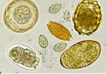 Trichinellose: Causes, symptômes et traitement naturel % de la Trichinellose