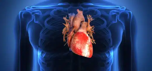 Cause et traitement naturel insuffisance cardiaque