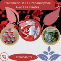 Traitement De La Drépanocytose Avec Les Plantes