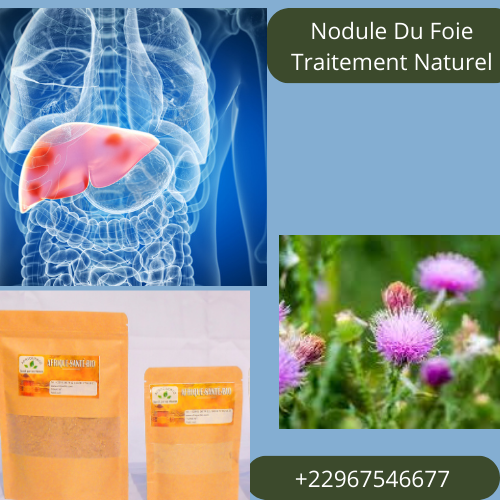 Nodule Du Foie Traitement Naturel