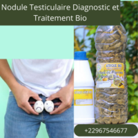 Nodule Testiculaire Diagnostic et Traitement Bio