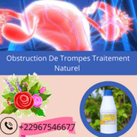 Obstruction De Trompes Traitement Naturel