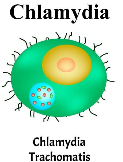 Chlamydia Symptômes Causes Traitements Naturel et Prévention