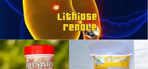 Soigner totalement la lithiase rénale