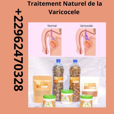 Soigner la Varicocèle: Traitement 100% Naturel de la Varicocèle