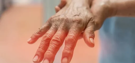 Guérir la polynévrite: soigner naturellement la polynévrite