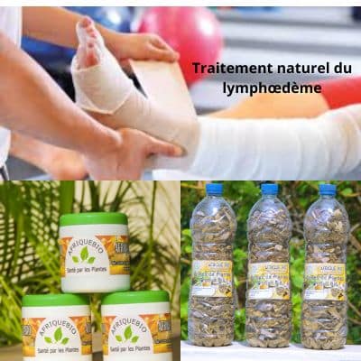 Comment soigner le lymphœdème?: Traitement 100 % Naturel