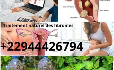 Soigner les myomes, fibromes: Traitement 100 % Naturel