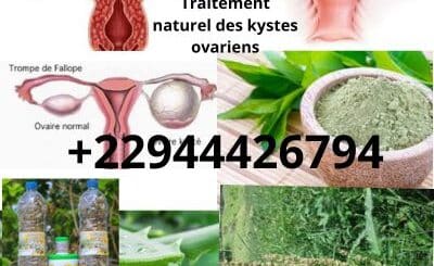 Comprendre les kystes ovariens: Traitement 100 % Naturel