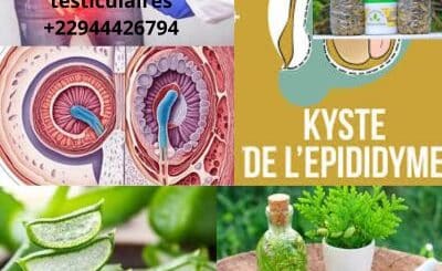 Kyste testiculaire: Traitement 100 % Naturel