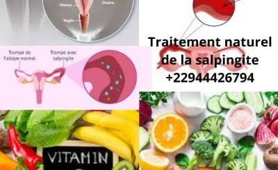 Comment soigner la salpingite? Traitement 100 % Naturel